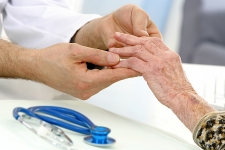 arthritis