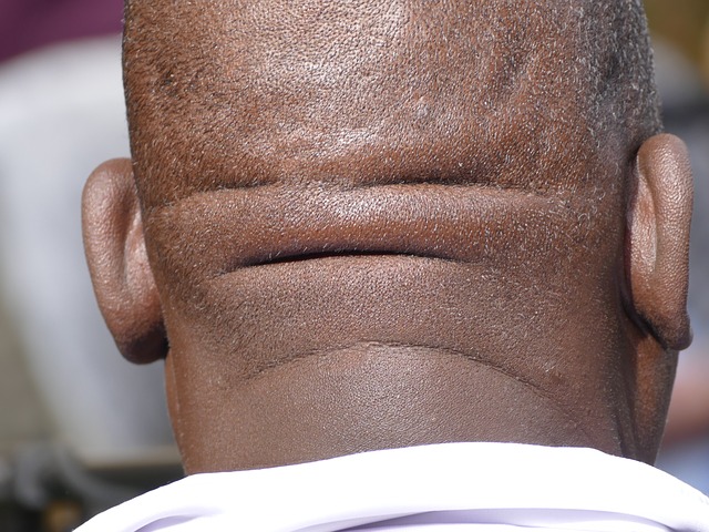 Conditions caused by Upper Neck Injuries