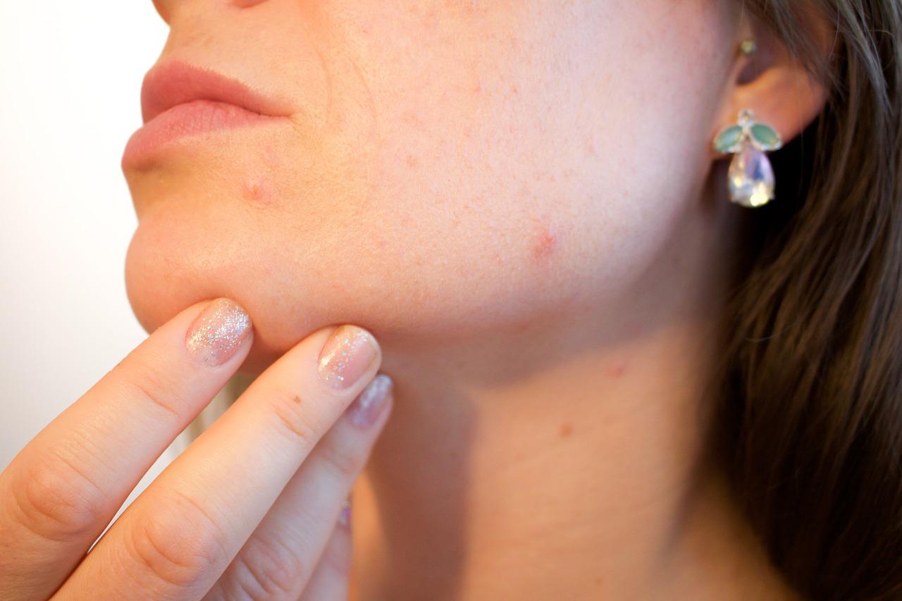 skin health